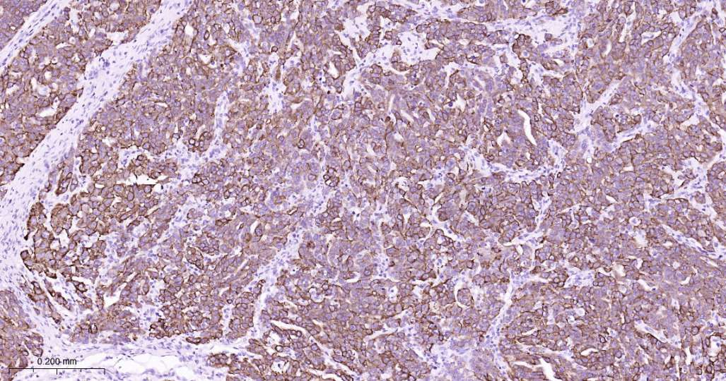 人Keratin 7即用型免疫组化试剂盒-IHC0604H